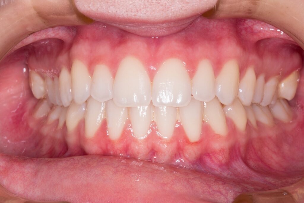teeth, smile, dentist-2339168.jpg